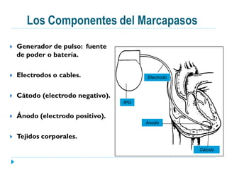Los Componentes del Marcapasos
   Generador de pulso: fuente
    de poder o batería.

   Electrodos o cables.                 Electrodo



   Cátodo (electrodo negativo).
                                   IPG


   Ánodo (electrodo positivo).
                                         Anodo


   Tejidos corporales.
                                                     Cátodo
 