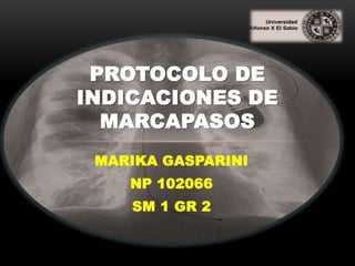 PROTOCOLO DE
INDICACIONES DE
  MARCAPASOS
 MARIKA GASPARINI
    NP 102066
    SM 1 GR 2
 