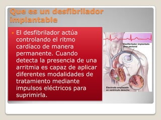 Que es un desfibrilador
implantable
   El desfibrilador actúa
    controlando el ritmo
    cardíaco de manera
    permanente. Cuando
    detecta la presencia de una
    arritmia es capaz de aplicar
    diferentes modalidades de
    tratamiento mediante
    impulsos eléctricos para
    suprimirla.
 
