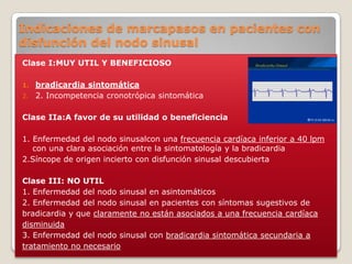 Indicaciones de marcapasos en pacientes con
disfunción del nodo sinusal
Clase I:MUY UTIL Y BENEFICIOSO

1. bradicardia sintomática
2. 2. Incompetencia cronotrópica sintomática


Clase IIa:A favor de su utilidad o beneficiencia

1. Enfermedad del nodo sinusalcon una frecuencia cardíaca inferior a 40 lpm
   con una clara asociación entre la sintomatología y la bradicardia
2.Síncope de origen incierto con disfunción sinusal descubierta

Clase III: NO UTIL
1. Enfermedad del nodo sinusal en asintomáticos
2. Enfermedad del nodo sinusal en pacientes con síntomas sugestivos de
bradicardia y que claramente no están asociados a una frecuencia cardíaca
disminuida
3. Enfermedad del nodo sinusal con bradicardia sintomática secundaria a
tratamiento no necesario
 