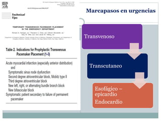 Marcapasos en urgencias
Transvenoso
Transcutaneo
Esofágico –
epicardio
Endocardio
 