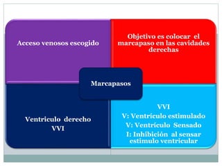 Acceso venosos escogido
Objetivo es colocar el
marcapaso en las cavidades
derechas
Ventriculo derecho
VVI
VVI
V: Ventrículo estimulado
V: Ventrículo Sensado
I: Inhibición al sensar
estimulo ventricular
Marcapasos
 