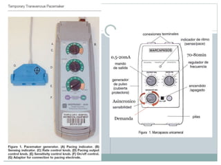 0.5-20mA
70-80min
Asincronico
Demanda
 