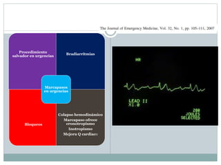 Procedimiento
salvador en urgencias
Bradiarritmias
Bloqueos
Colapso hemodinámico
Marcapaso ofrece
cronotropismo
Inotropismo
Mejora Q cardiaco
Marcapasos
en urgencias
 
