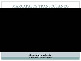 MARCAPASOS TRANSCUTANEO
Sedación y analgesia
Puente al Transvenoso
 