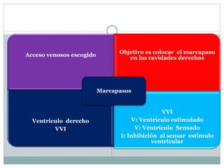 Acceso venosos escogido
Objetivo es colocar el marcapaso
en las cavidades derechas
Ventriculo derecho
VVI
VVI
V: Ventrículo estimulado
V: Ventrículo Sensado
I: Inhibición al sensar estimulo
ventricular
Marcapasos
 