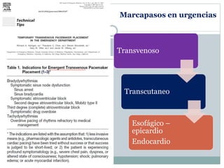 Marcapasos en urgencias
Transvenoso
Transcutaneo
Esofágico –
epicardio
Endocardio
 