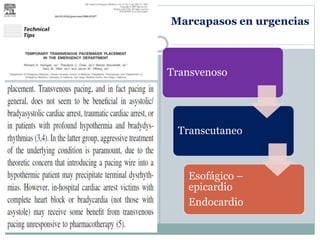 Marcapasos en urgencias
Transvenoso
Transcutaneo
Esofágico –
epicardio
Endocardio
 