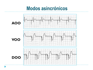 Modos asincrónicos
AOO
VOO
DOO
 