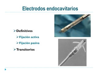 Electrodos endocavitarios
Ø Definitivos
Ø Fijación activa
Ø Fijación pasiva
Ø Transitorios
 
