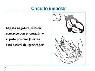 Circuito unipolar
El polo negativo está en
contacto con el corazón y
el polo positivo (tierra)
está a nivel del generador
 