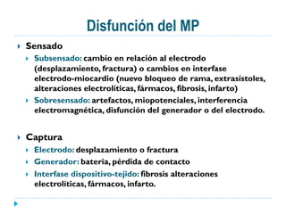 Disfunción del MP
}  Sensado
}  Subsensado: cambio en relación al electrodo
(desplazamiento, fractura) o cambios en interfase
electrodo-miocardio (nuevo bloqueo de rama, extrasístoles,
alteraciones electrolíticas, fármacos, fibrosis, infarto)
}  Sobresensado: artefactos, miopotenciales, interferencia
electromagnética, disfunción del generador o del electrodo.
}  Captura
}  Electrodo: desplazamiento o fractura
}  Generador: bateria, pérdida de contacto
}  Interfase dispositivo-tejido: fibrosis alteraciones
electrolíticas, fármacos, infarto.
 