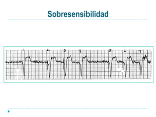 Sobresensibilidad
 