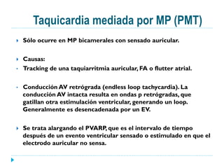 Taquicardia mediada por MP (PMT)
}  Sólo ocurre en MP bicamerales con sensado auricular.
}  Causas:
•  Tracking de una taquiarritmia auricular, FA o flutter atrial.
•  Conducción AV retrógrada (endless loop tachycardia). La
conducción AV intacta resulta en ondas p retrógradas, que
gatillan otra estimulación ventricular, generando un loop.
Generalmente es desencadenada por un EV.
}  Se trata alargando el PVARP, que es el intervalo de tiempo
después de un evento ventricular sensado o estimulado en que el
electrodo auricular no sensa.
 