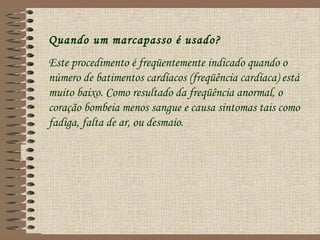 Quando um marcapasso é usado?
Este procedimento é freqüentemente indicado quando o
número de batimentos cardíacos (freqüência cardíaca) está
muito baixo. Como resultado da freqüência anormal, o
coração bombeia menos sangue e causa sintomas tais como
fadiga, falta de ar, ou desmaio.
 