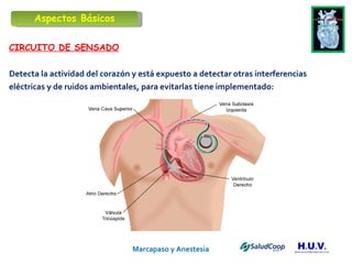 Marcapaso y Anestesia   CIRCUITO DE SENSADO Detecta la actividad del corazón y está expuesto a detectar otras interferencias eléctricas y de ruidos ambientales, para evitarlas tiene implementado: Aspectos Básicos 