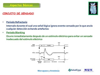 Marcapaso y Anestesia   CIRCUITO DE SENSADO Periodo Refractario Intervalo durante el cual una señal lógica ignora evento censado por lo que anula cualquier detección evitando artefactos Periodo Blanking Ocurre inmediatamente después de un estímulo eléctrico para evitar un sensado inadecuado del estímulo eléctrico Aspectos Básicos 