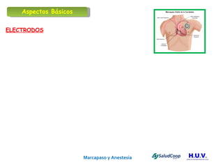 Marcapaso y Anestesia   ELECTRODOS Aspectos Básicos 