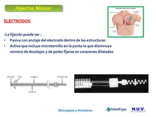 Marcapaso y Anestesia   ELECTRODOS -La fijación puede ser : Pasiva con anclaje del electrodo dentro de las estructuras  Activa que incluye microtornillo en la punta lo que disminuye  número de desalojos y de poder fijarse en corazones dilatados Aspectos Básicos 