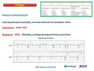 Marcapaso y Anestesia   MODOS ASINCRONICOS Esta desactivado el sensado, se emite estímulo sin considerar ritmo  Unicameral   AOO  VOO  Bicameral   DOO   Obsoleto, protegía de taquiarritmias auriculares Códigos 