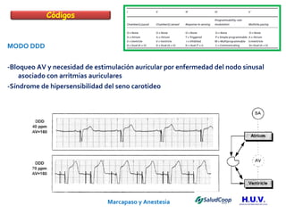 Marcapaso y Anestesia   MODO DDD -Bloqueo AV y necesidad de estimulación auricular por enfermedad del nodo sinusal asociado con arritmias auriculares -Síndrome de hipersensibilidad del seno carotideo Códigos 