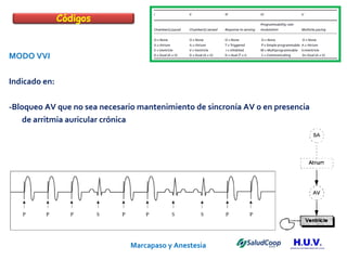Marcapaso y Anestesia   MODO VVI Indicado en: -Bloqueo AV que no sea necesario mantenimiento de sincronía AV o en presencia  de arritmia auricular crónica Códigos 