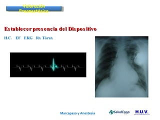 Marcapaso y Anestesia   Establecer presencia del Dispositivo H.C.  EF  EKG  Rx Tórax Valoración Preanestésica 