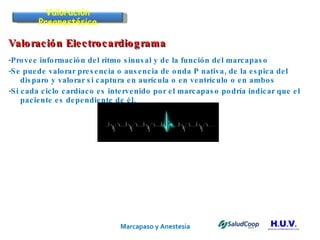 Marcapaso y Anestesia   Valoración Electrocardiograma -Provee información del ritmo sinusal y de la función del marcapaso -Se puede valorar presencia o ausencia de onda P nativa, de la espica del disparo y valorar si captura en aurícula o en ventrículo o en ambos -Si cada ciclo cardiaco es intervenido por el marcapaso podría indicar que el paciente es dependiente de él. Valoración Preanestésica 