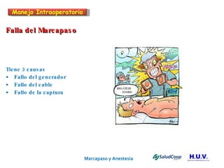 Marcapaso y Anestesia   Falla del Marcapaso Tiene 3 causas Fallo del generador  Fallo del cable Fallo de la captura Manejo Intraoperatorio 
