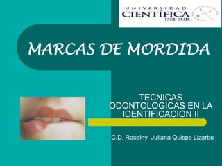 MARCAS DE MORDIDA 
TECNICAS 
ODONTOLOGICAS EN LA 
IDENTIFICACION II 
C.D. Roselhy Juliana Quispe Lizarbe 
 