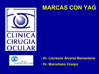 - Dr. Laureano Álvarez-Rementería
- Dr. Marceliano Crespo
MARCAS CON YAG
 