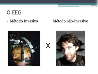 O EEG
• Método Invasivo Método não-invasivo
X
 