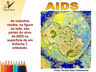As manchas
verdes, na figura
  ao lado, são
 partes do vírus
   da AIDS na
superfície de um
   linfócito T,
   infectado.




                    Fonte: Revista Super Interessante
 
