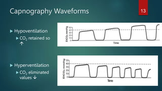 Capnography Waveforms
 Hypoventilation
 CO2 retained so values

 Hyperventilation
 CO2 eliminated so
values 
13
 