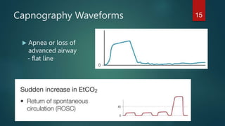 Capnography Waveforms
 Apnea or loss of
advanced airway
- flat line
15
 