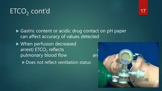 ETCO2 cont’d
 Gastric content or acidic drug contact on pH paper
can affect accuracy of values detected
 When perfusion decreased (shock,
arrest) ETCO2 reflects change in
pulmonary blood flow and CO2 level
 Does not reflect ventilation status
17
 