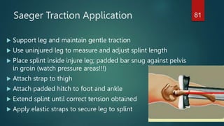 Saeger Traction Application
 Support leg and maintain gentle traction
 Use uninjured leg to measure and adjust splint length
 Place splint inside injure leg; padded bar snug against pelvis
in groin (watch pressure areas!!!)
 Attach strap to thigh
 Attach padded hitch to foot and ankle
 Extend splint until correct tension obtained
 Apply elastic straps to secure leg to splint
81
 