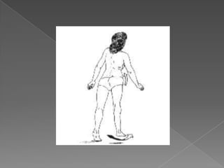 MarchaparkinsonianaEnfermedad de Parkinson.Características:Se ve en pacientes con enfermedad de Parkinson y se caracteriza por pasos cortos, una postura del cuerpo flexionada hacia adelante, con riesgo de perder la estabilidad, y ausencia de braceo. 