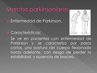 Marcha miopática, balanceante.“marcha de pato”   En este tipo de marcha el paciente, por afectación de los músculos de la cintura   pélvica, camina balanceando el cuerpo  (hacia uno y otro lado), con exageración de la lordosis lumbarDistrofia muscular progresivatipoDuchenne