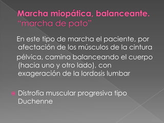 Distrofia muscular de duchenneEnfermedadhereditaria en mascomun en hombres , miopatica o destruccion del musculoestriado, ocasionadiferenciasmotoras, contracturasescoliosispuede ser porpreudohipertrofia(escuanto el tejidomuscular se sustituyeportejidograso)