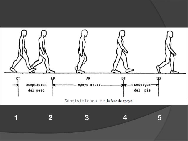 Marcha humana, Alteraciones y corrección de la marcha, Marcha patológ…