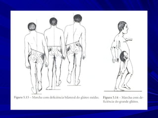 Marcha normal e_patologica