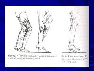 Marcha normal e_patologica