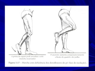Marcha normal e_patologica