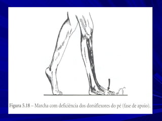 Marcha normal e_patologica