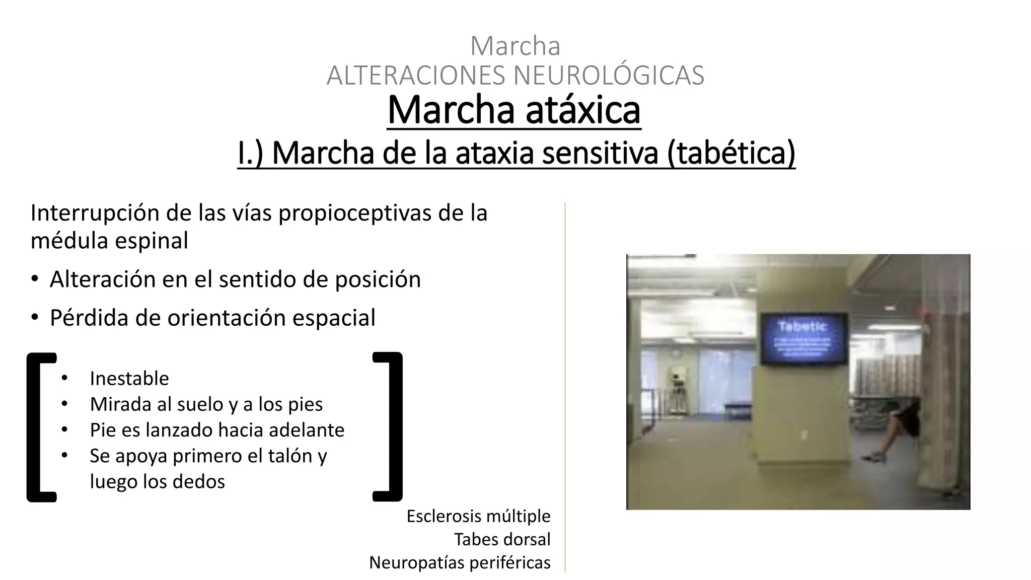 Marchas patológicas | PPT