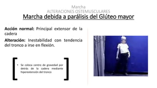 Marcha
ALTERACIONES OSTEMUSCULARES
Marcha debida a parálisis del Glúteo mayor
Acción normal: Principal extensor de la
cadera
Alteración: Inestabilidad con tendencia
del tronco a irse en flexión.
[ ]• Se coloca centro de gravedad por
detrás de la cadera mediante
hiperextensión del tronco
 