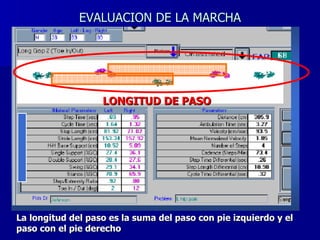 EVALUACION DE LA MARCHA LONGITUD DE PASO La longitud del paso es la suma del paso con pie izquierdo y el paso con el pie derecho 