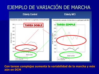EJEMPLO DE VARIACIÓN DE MARCHA TAREA DOBLE TAREA SIMPLE Con tareas complejas aumenta la variabilidad de la marcha y más aún en DCM 