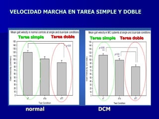 VELOCIDAD MARCHA EN TAREA SIMPLE Y DOBLE Tarea simple Tarea simple Tarea doble Tarea doble normal DCM 